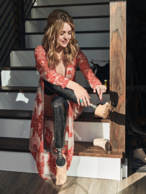 Amy Purdy, a paralympic snowboarder.